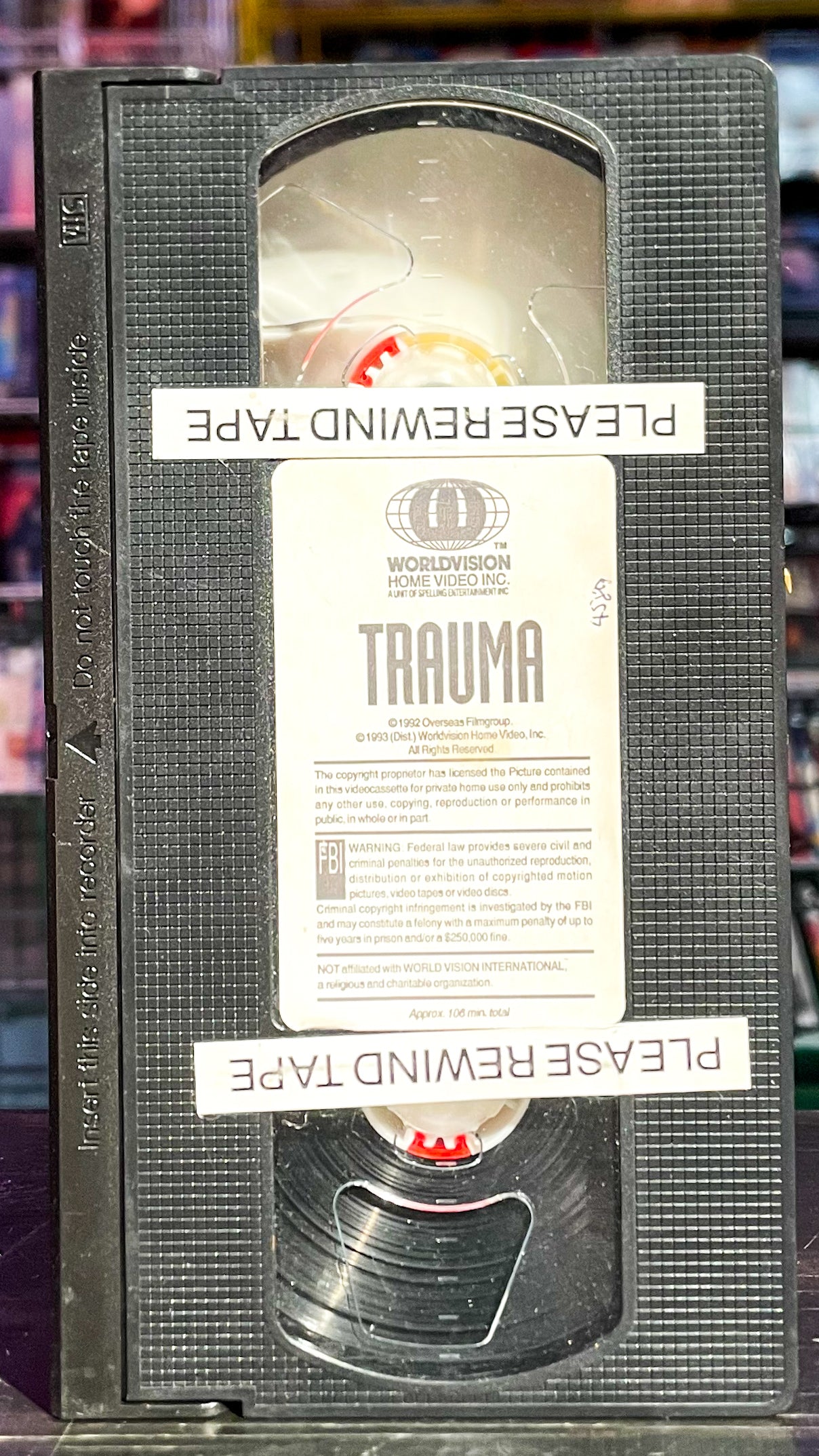 Trauma
